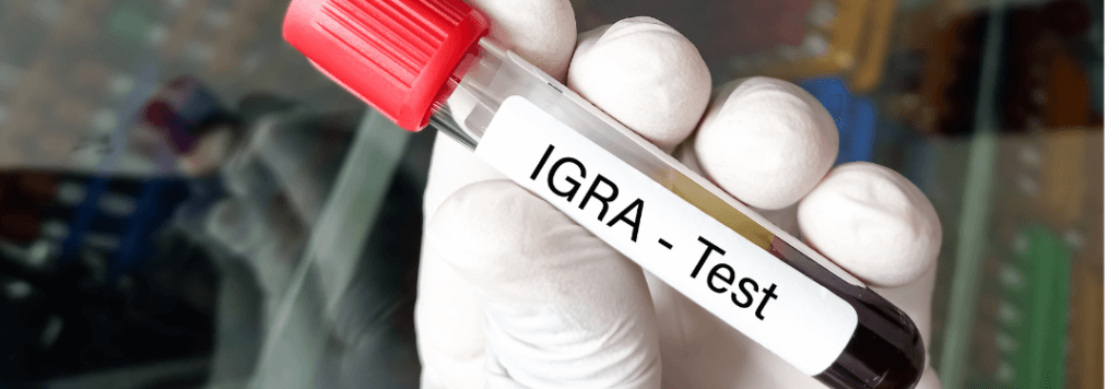 IGRA/QuantiFERON-TB Test | How Often Employers Need to TB Test Their Team | Mobile Health | Employee TB Testing